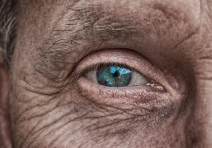 敏感肌の人がワキガ対策においてどのくらいの効果があるか？