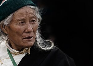 ワキガの体臭対策にはどんな方法が効果的？